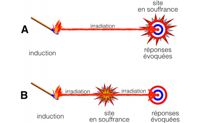 La prise en charge de l'arthrose par la physiothérapie